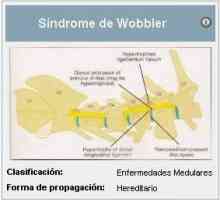 Wobbler सिंड्रोम