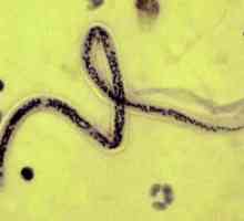 Filariasis या आंतरिक परजीवी