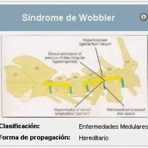 Wobbler सिंड्रोम