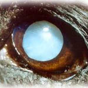आँखों की बीमारियां: मोतियाबिंद